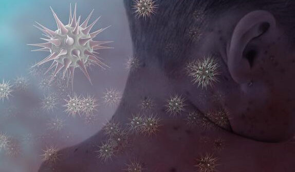 COVİD-19-dan sonra yeni virus yayılır – 3 nəfərdən birini öldürür