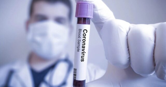 Azərbaycanda koronavirusa yoluxanların bu günə olan statistikası
