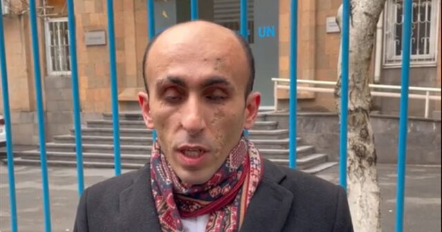 “Şahramanyanın fərmanı qanunsuzdur” – Beqlaryan ÜSYANA QALXDI