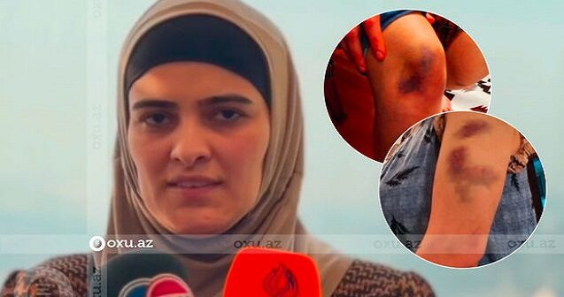 Arvadını döydüyü iddia olunan müstəntiq barədə qərar verildi