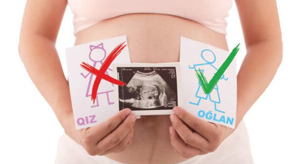 Azərbaycan selektiv aborta görə dünyada birinci yerdədir