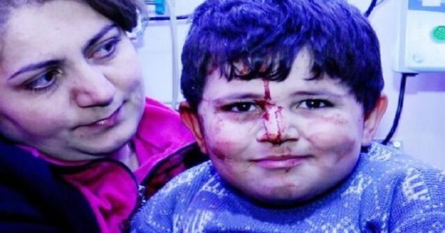 Gəncə terrorunun canlı şahidləri: Balaca Bəxtiyar üç il sonra (VİDEO)