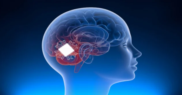 Neuralink neyroçipi ilk insan beyninə uğurla implantasiya edilib