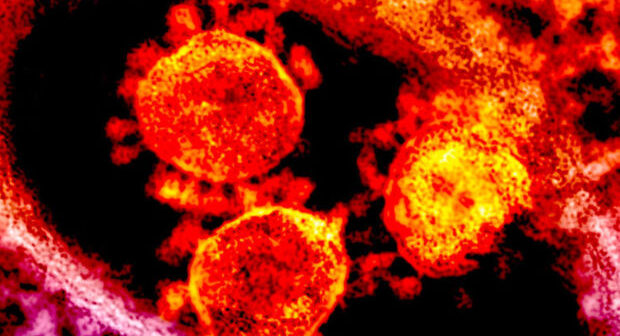 Xəbərdarlıq: Koronavirusun yeni növü 100 faiz ölümcüldür