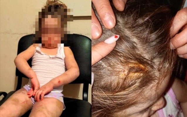 Azyaşlı ona işgəncə verən anasından alındı – FOTO