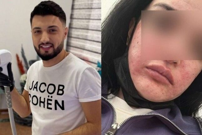 “Dedilər ki, üzümü bu hala qoyan Əmrah həkim yox, bərbərdir”